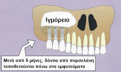 v:shapes="_x0000_s1693"