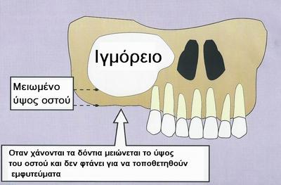 v:shapes="_x0000_s1690"