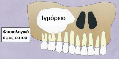v:shapes="_x0000_s1689"